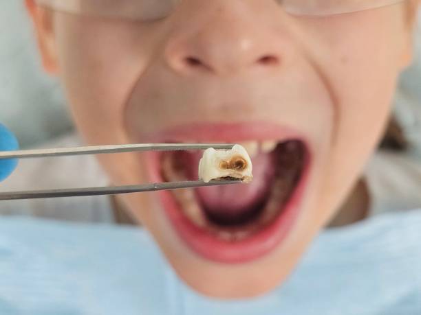 Emergency Dentist Open Today in SD