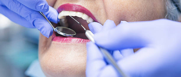 Best Broken Tooth Emergency  in Britton, SD